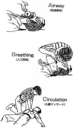 「気道確保、人工呼吸、心臓マッサージ」のイメージ図