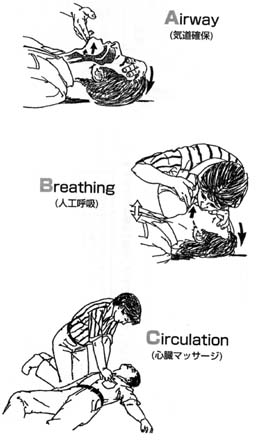 A気道確保B人工呼吸C心臓マッサージ